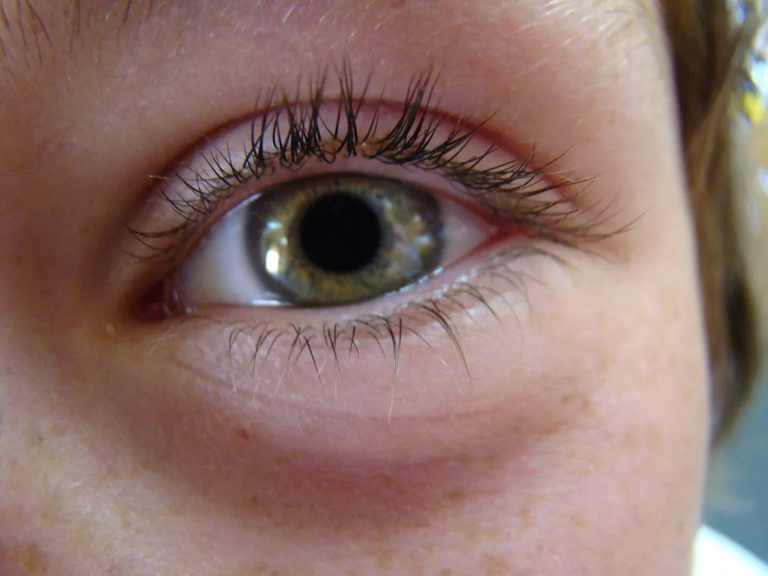 Close-up of a human eye with visible eyelashes and eyebrow, highlighting light skin with freckles and redness under the eye—a subtle nod to Glamesia-inspired fashion beauty.