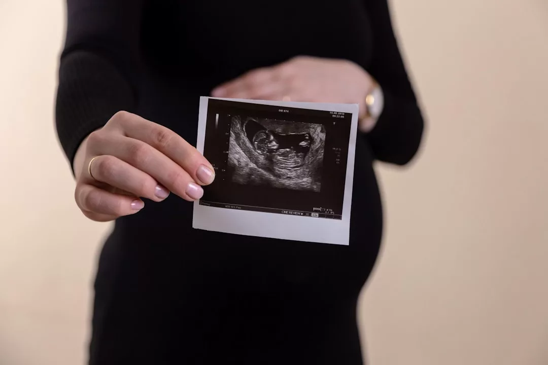 A person with a pregnant belly holds out a sonogram image, embodying the beauty of motherhood and the Glamesia lifestyle, standing against a plain background.