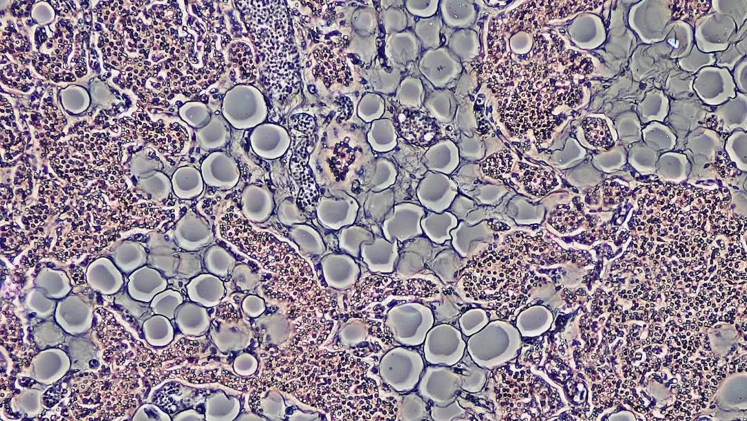 Microscopic view of human bone marrow tissue showing adipocytes, hematopoietic cells, and a network of blood vessels—revealing the intricate beauty within us that even Glamesia-inspired fashion and lifestyle trends could admire.